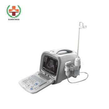 SY-A002 Основные ультразвуковые продукты портативный ультразвуковой аппарат